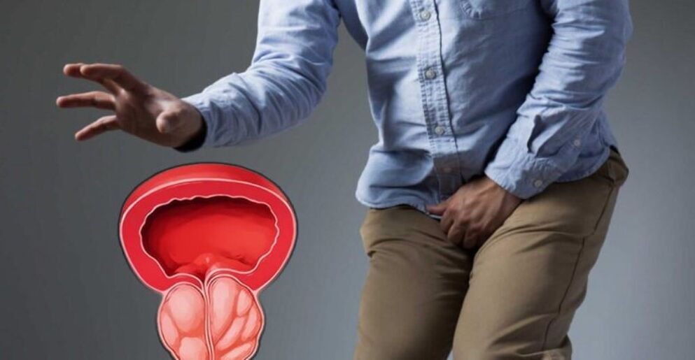 sintomas de prostatite em homens